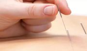 Acupuncture Clinic in Tallaght - Shamrock Health Centre